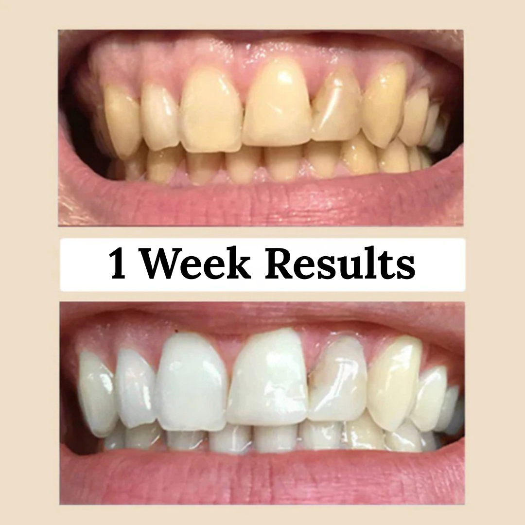 Miswak Natural Teeth Whitening