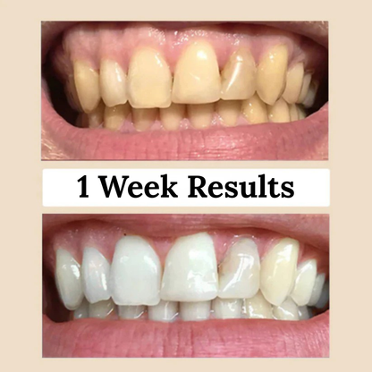 Miswak Natural Teeth Whitening